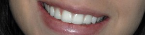 Tratamientos Odontología, Patología oral, Implantes. Clínica Nieves